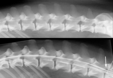 Radiograph (x-ray) of a dog's spine and part of a lumbar myelogram. The dog is lying on its side, with the head facing the left. The top image is a plain radiograph, the bottom image is the myelogram. The white arrow is pointing at the spinal needle, which is injecting the white contrast material, outlining the spinal cord. This part of the myelogram is normal.